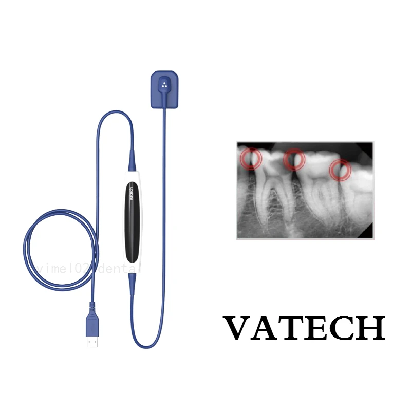 

VATECH RVG Dental Imaging System Soft Intraoral Digital X-Ray EZ SENSOR SIZE 1.5
