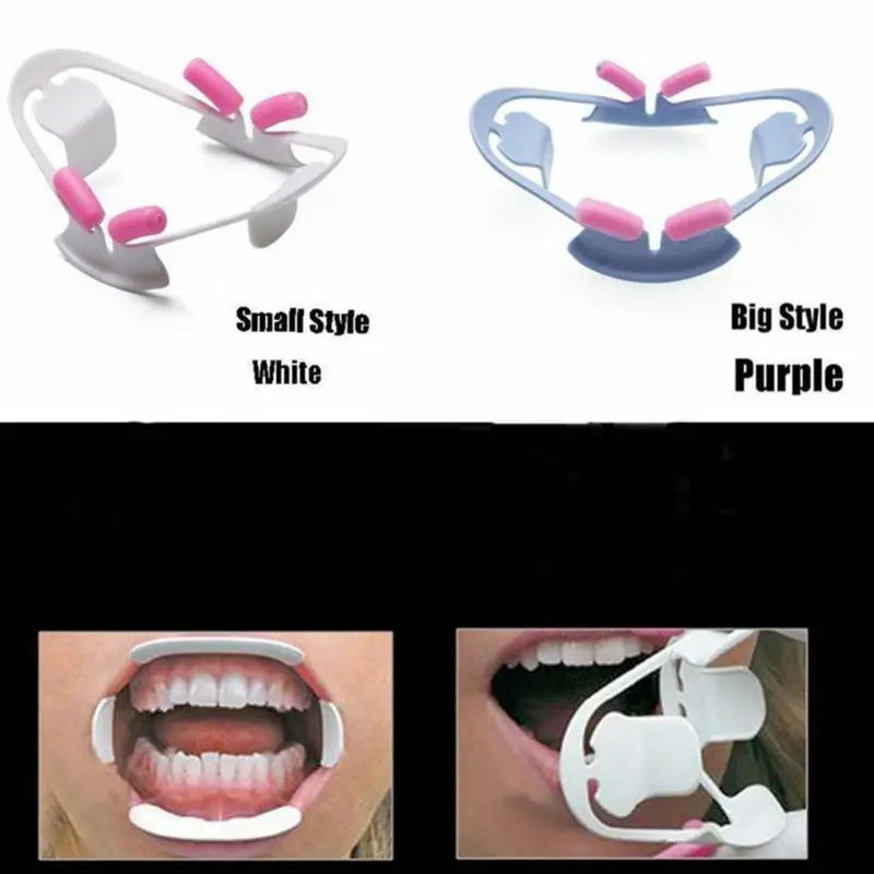 

3D Oral Dental Lip Retractor Mouth Opener Orthodontic Intraoral Cheek Prop Tools 50JF