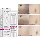 Mango удалить Беременность уменьшение постугревых рубцов, растяжек крем уход материнской анти-старения, против морщин Укрепляющий крем для тела TSLM1