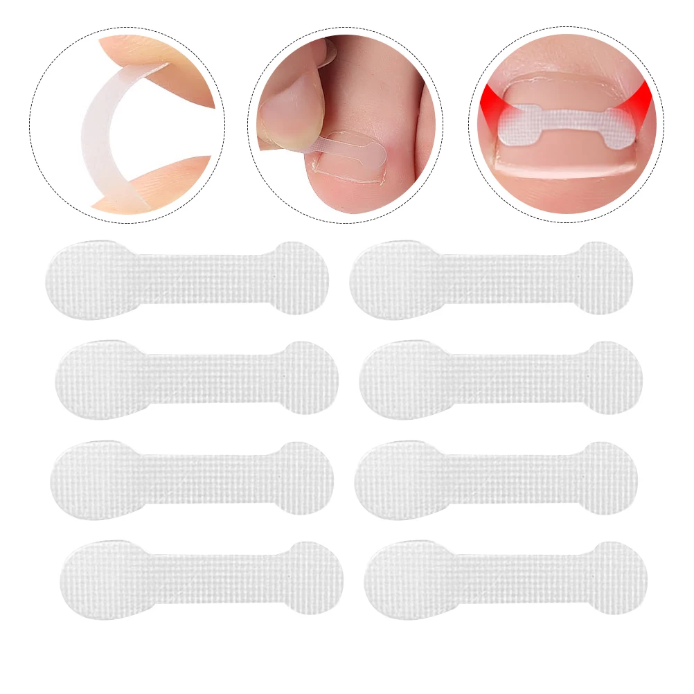 

30pcs Toenail Orthopaedic Stickers Quickly Toenail Strips Toenail Patches