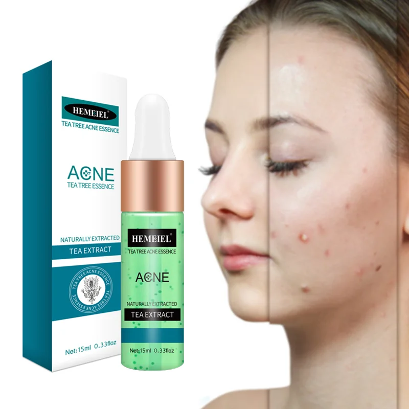 

Tea Tree Oil Serum Acne Treatment Hyaluronic Acid Face Serum Moisturizer Whitening Essence Skin Care Cosmetics 15ml