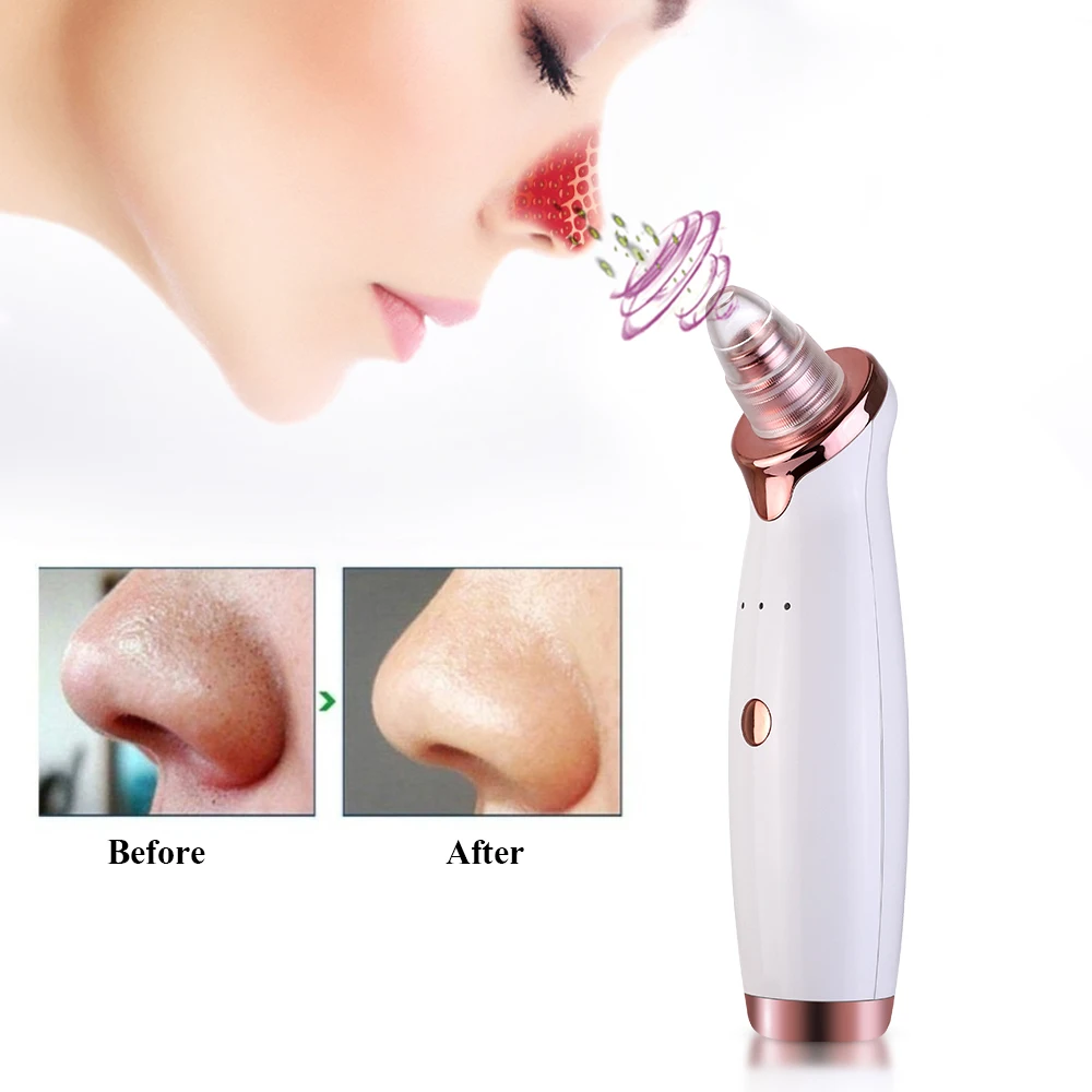 Electric Blackhead Remover Vacuum New Nose Face Deep Cleansing Machine Girl's Gift Skin Care Device Face Cleaning Tool