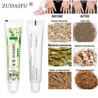 100% оригинальный крем zudaifu для кожи при псориазе дерматите экземе мазь для лечения псориаза крем для ухода за кожей