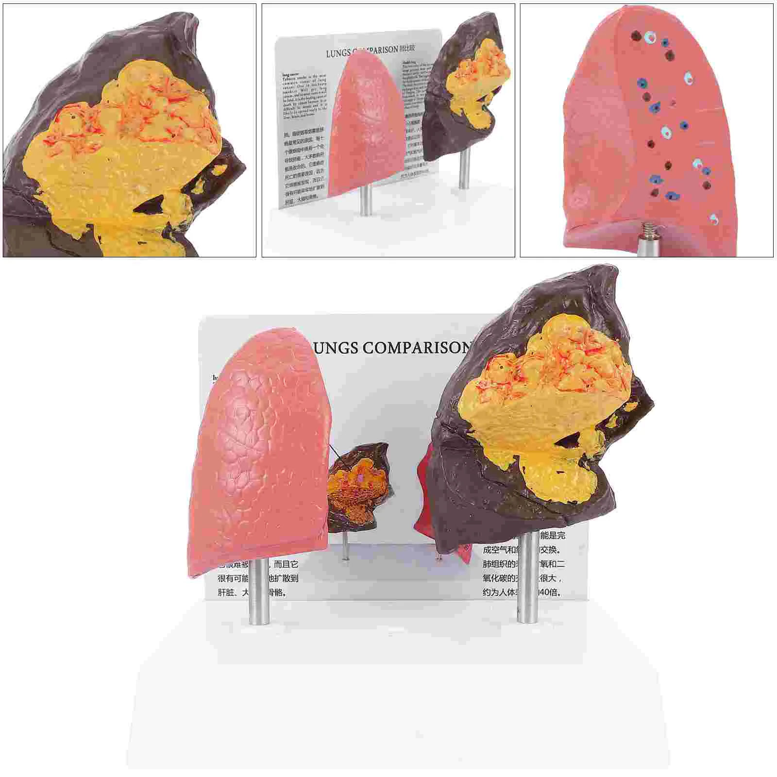 

1 Pc Human Body Lung Anatomy Model Teaching Model Smoking Lung Model