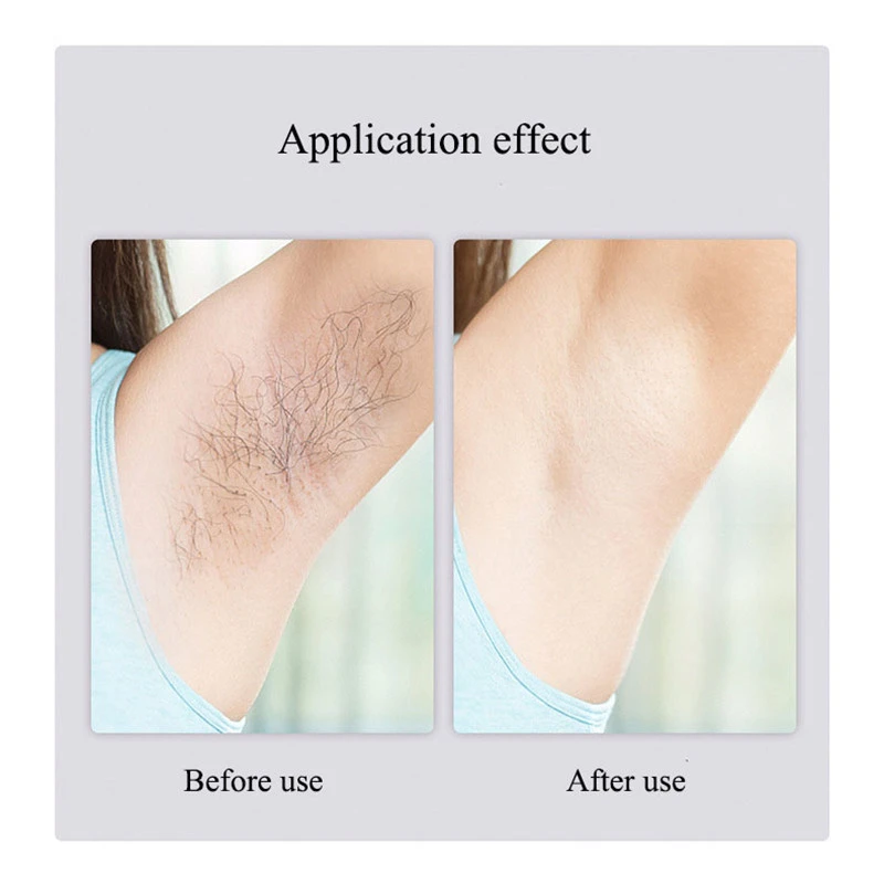

2021 New Laser Epilator For Women Permanent IPL Hair Removal Machine Female Body Bikini Photoepilator Flawless Depilator