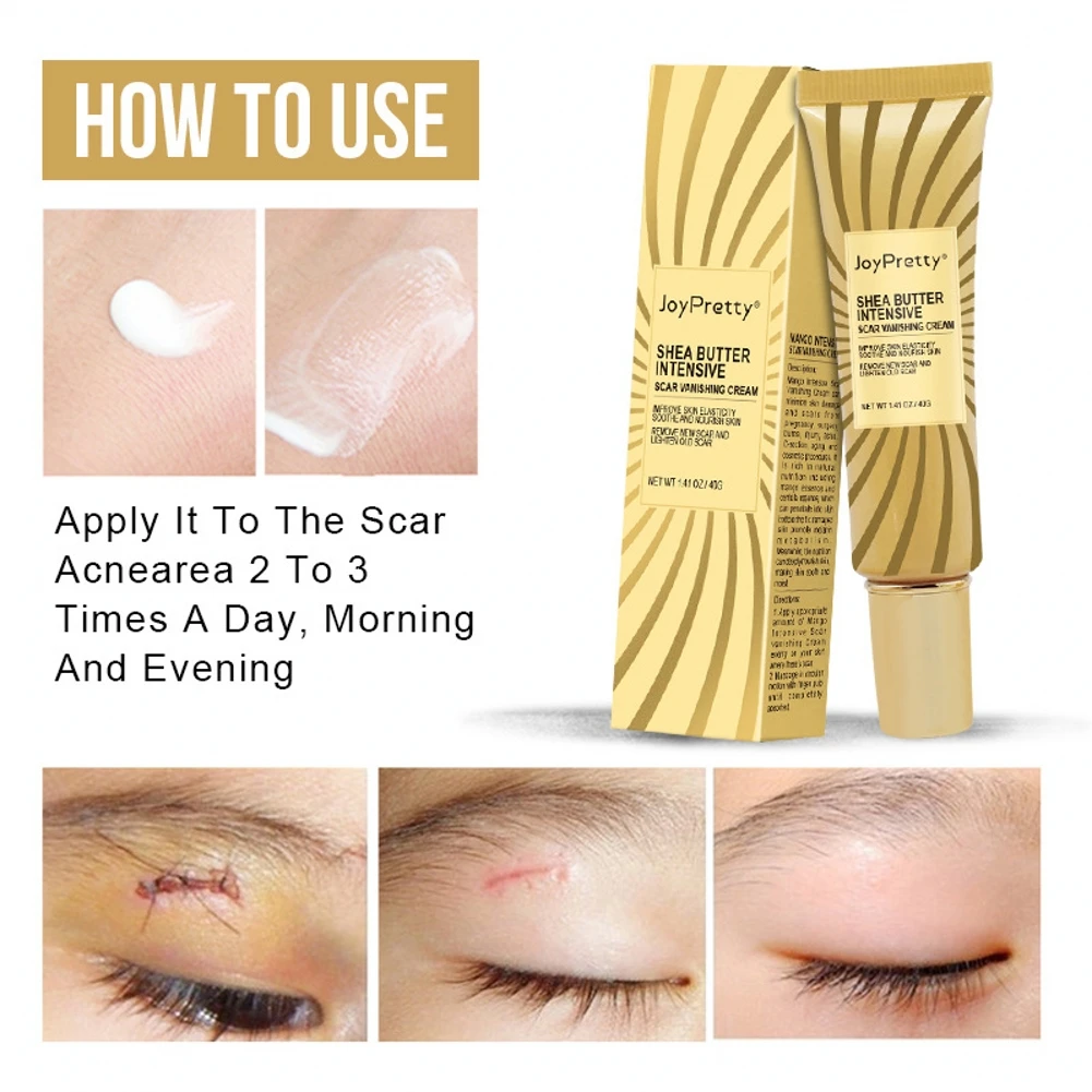 40g Acne Scar Removal Cream Pimples Stretch Marks Face Gel Remove Smoothing Whitening Moisturizing Body Skin Care | Красота и