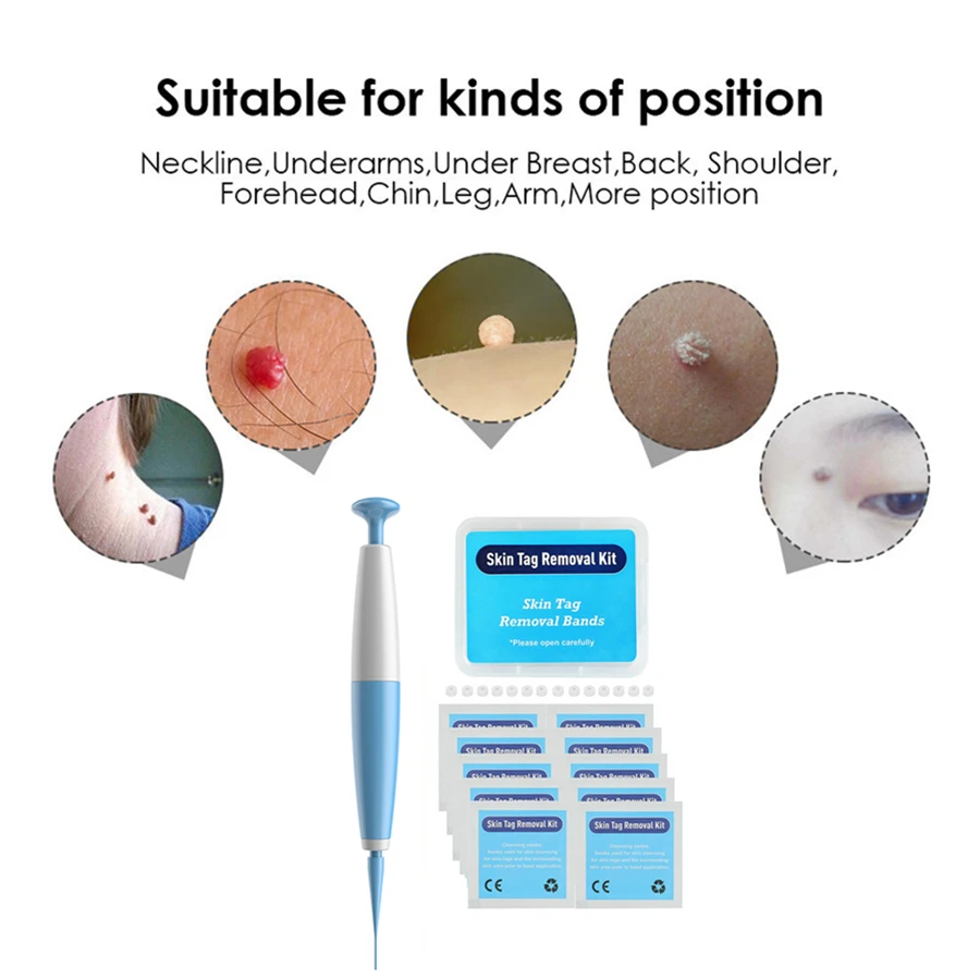 Auto Band Non Toxic Face Care Mole Wart Tool For Small To Medium Blue Skin Tag Removal Kit With Cleansing Swabs Home Use Adult |