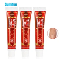 30g varicose veins cream herbal extracts vasculitis phlebitis spider ointment varicosity angiitis removal pain relief plaster