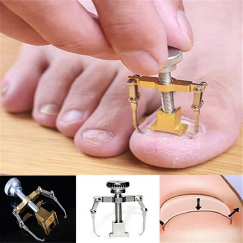 

4-60Pcs Nail Strips Anti-roll Nail Free Glue Toe Inlay Nail Corrector Nail Patch Correction Stickers Toenail Nail Care Foot Care