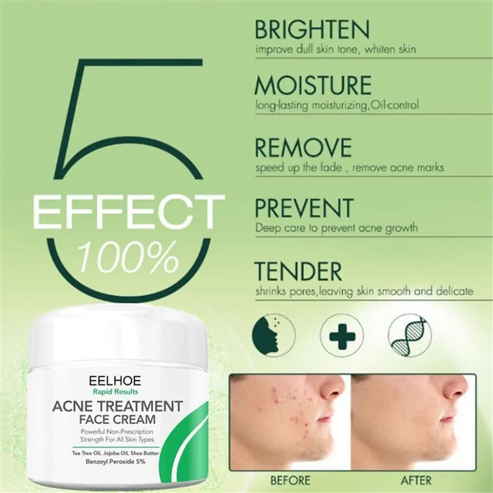 

Acne Spot Treatment Acne Removal Moisturizer Whitening Facial Cream Reduce Blemishes Natural Scars Treatment