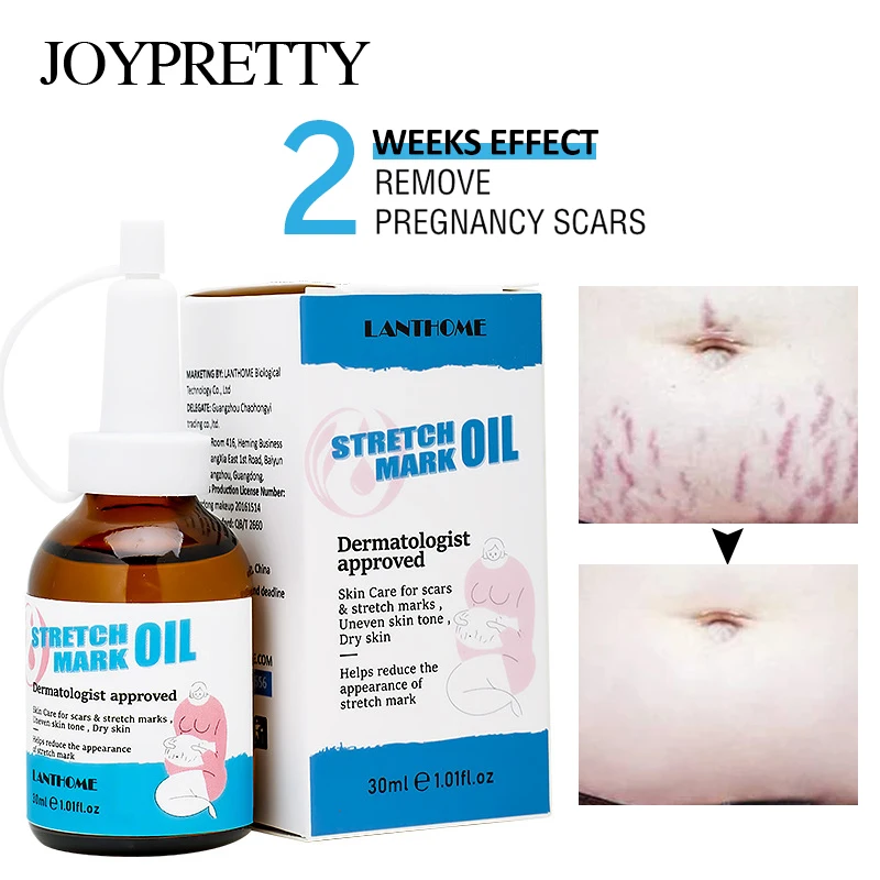 

Крем Для Удаления растяжек, эфирное масло для ухода за кожей, для Удаления растяжек, для беременных