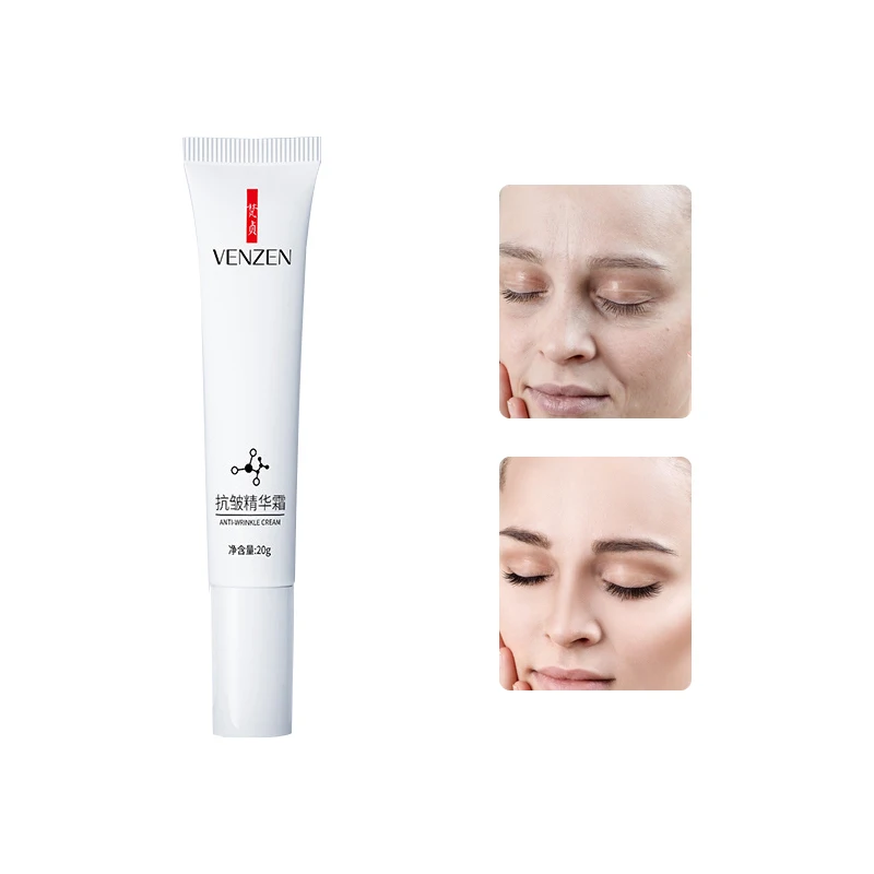 

Effective Anti Wrinkle Cream Remove Melasma Spot Pigment Melanin Dark Spots Pigmentation Moisturizing Anti Aging Whitening Cream