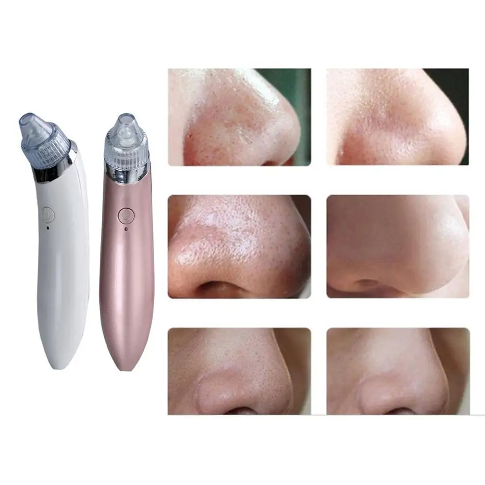 

Household Rechargeable Vacuum Blackhead Remover Facial Vacuum Pore Cleaner Nose Acne Facial Skin Care Device