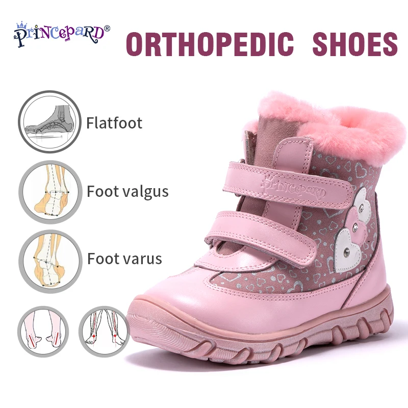 Princepard 100% natural fur genuine leather orhopedic shoes for girls 22-28 size pink winter orthopedic kids | Детская одежда и