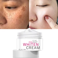 effective whitening freckle cream remove dark spots anti freckle cream fade pigmentation melasma brighten cream skin care vova