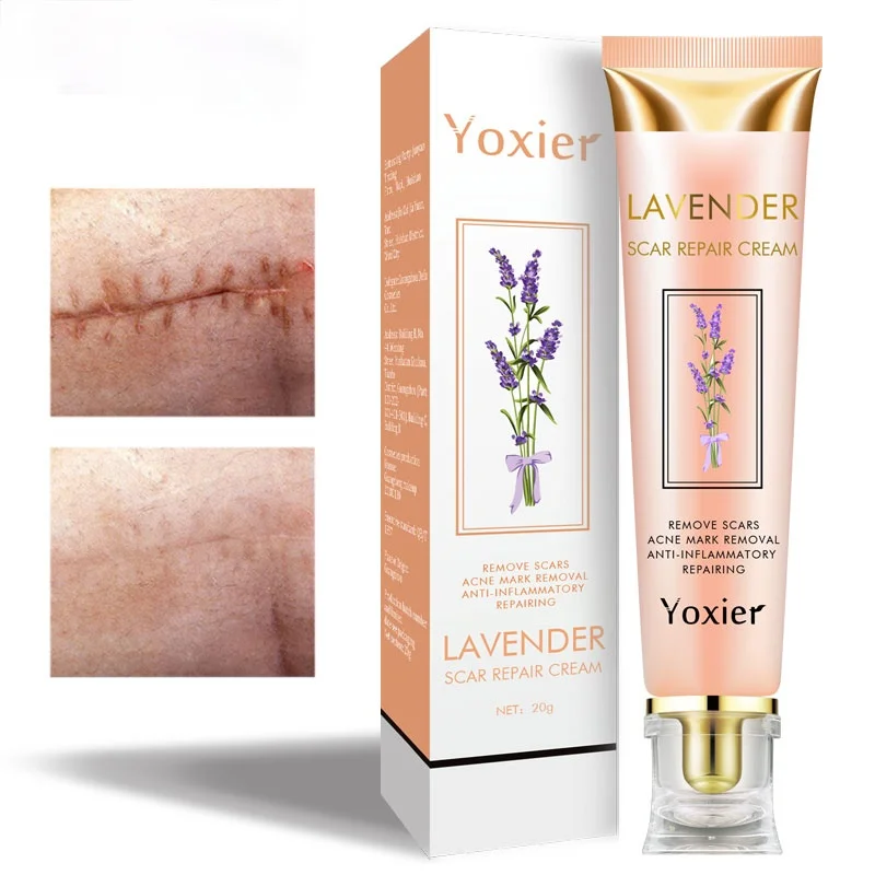Крем для восстановления шрамов лаванды восстанавливающий шрамы от ожогов