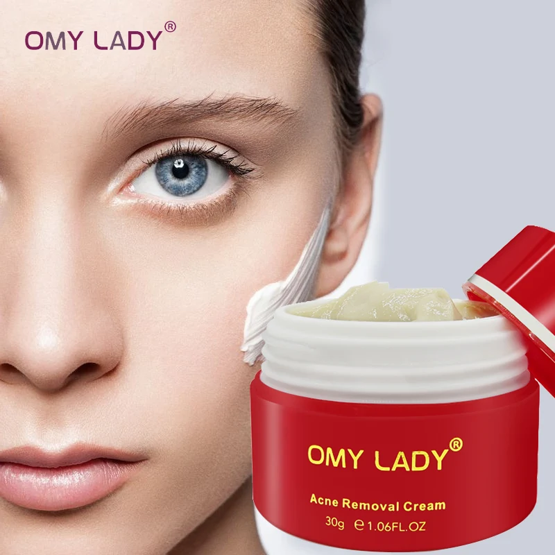 Сыворотка от акне OMY LADY с алоэ вера 100% растительный Крем для лечения рубцов после