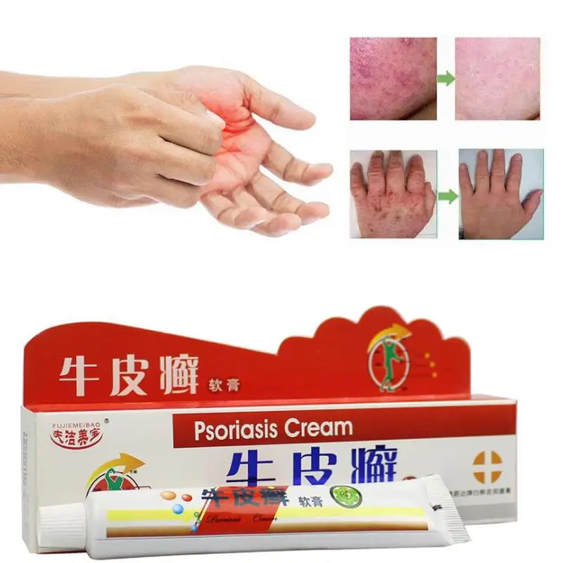 1pc Dermatologist Skin Ringworm King Ointment Genuine Psoriasis Sweat Spot Chinese Medicine Care | Красота и здоровье