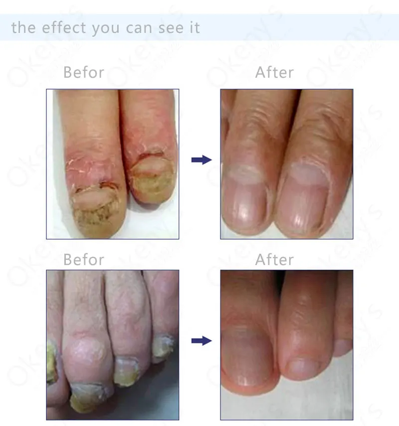 3 шт. лечебная формула для восстановления ногтей жидкая легкая пудра ARMOR Essence