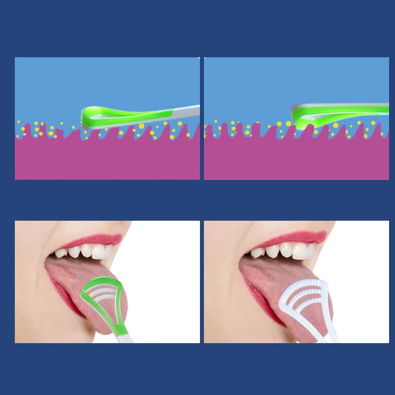 

5PCS Tongue Cleaner Scraper for Oral Hygiene Keep Fresh Breath Tongue Clean Tools