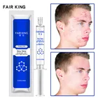 Жидкость для инъекций с гиалуроновой кислотой, лечение акне, против морщин, против старения, питает, увлажняет, осветляет кожу лица, эссенция