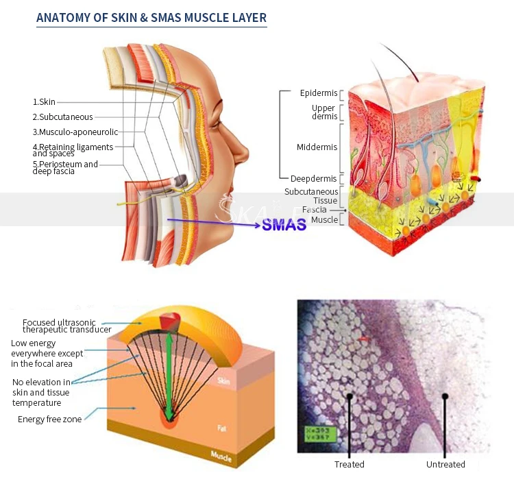 Цена по прейскуранту завода лучшие продажи анти-старения кожи подтяжки морщин