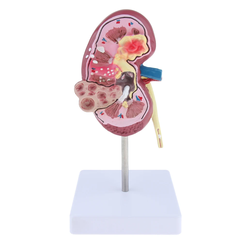 Цельнокроеное платье 2-сторонняя почка человека анатомическая модель нормальной