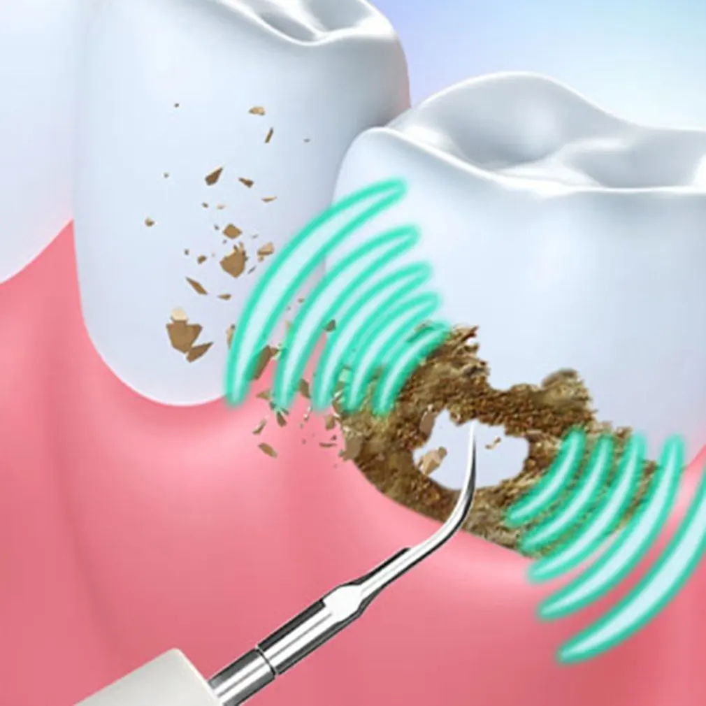 

1 Set Ultrasonic Calculus Remover Scaling Electric Portable Scaler Smoke Stains Tartar Plaque Teeth Color Random