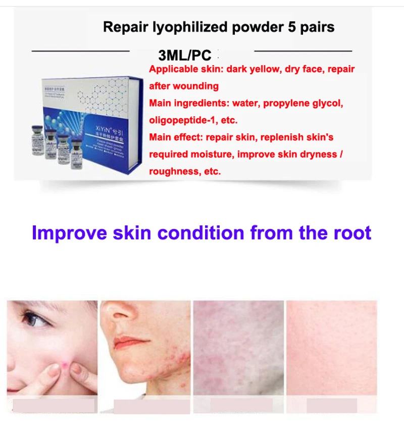 Peptide Lyophilized Powder Serum Acne Wrinkle Pimples Treatment Epidermal Growth Factor Hydrating Moisturizing Skin Care | Красота и