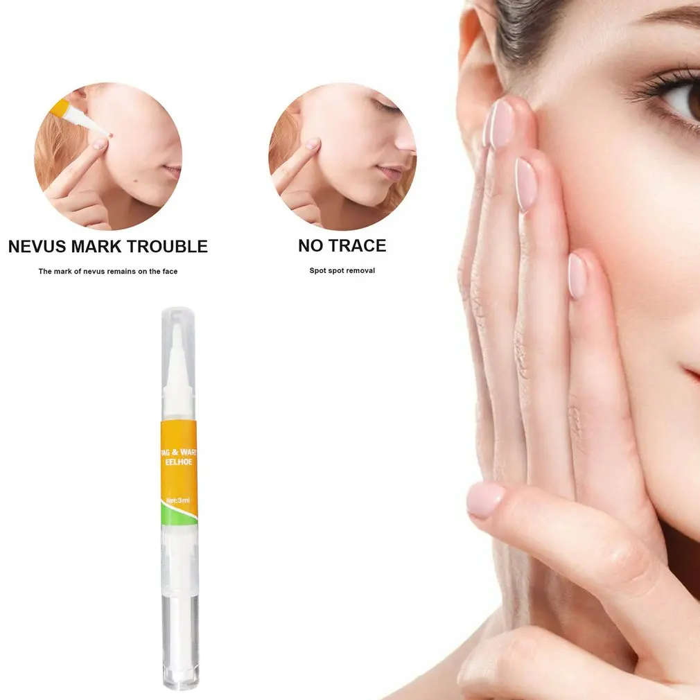 

Point Mole Pen Removal Of Nevus Planus Care Repair Solution No Trace High Performance Penetration Nevus Removal Tool