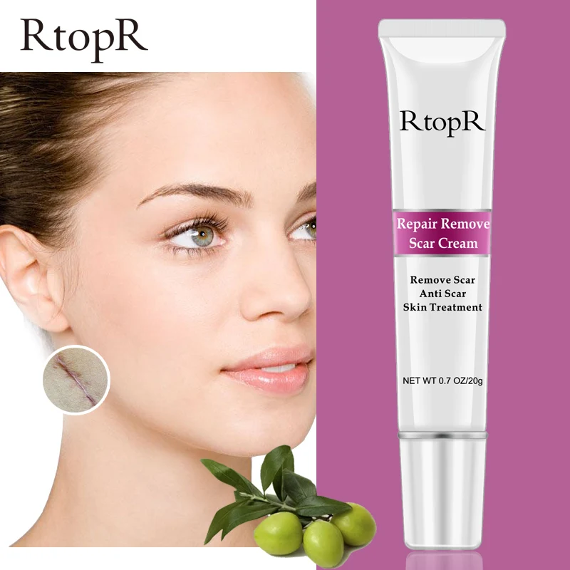 Крем Для Удаления растяжек от акне угрей и пятен 20 г|Автозагары бронзаторы для