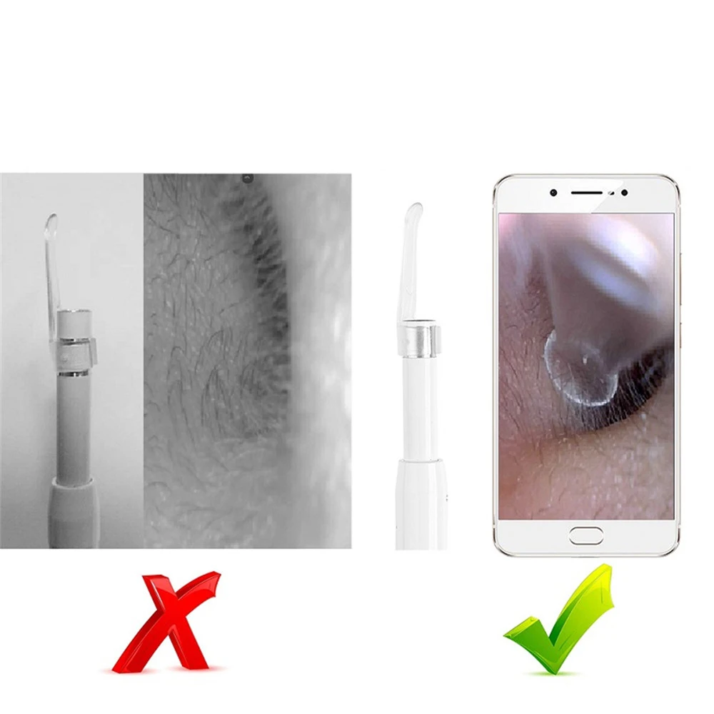 

3 in 1 Ear Endoscope Visual Ear Spoon 2M cable 5.5mm Mini Camera Diagnostic Tool Health Care Visual Ear Cleaning Ear Pick