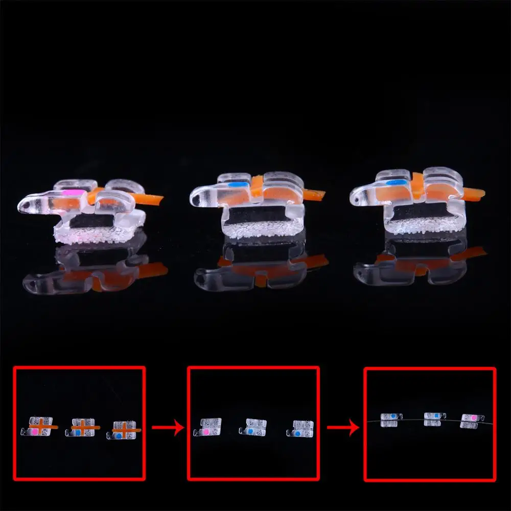 Зубные ортодонтические монокристаллические блестящие прозрачные брекеты AZDENT Mini