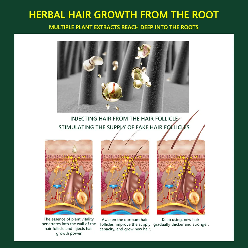 Средство от выпадения волос натуральное|Средства волос| |