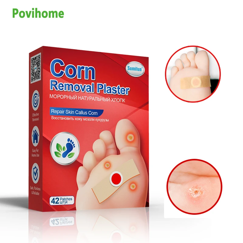 

42 шт., инструмент для безболезненного удаления мозолей