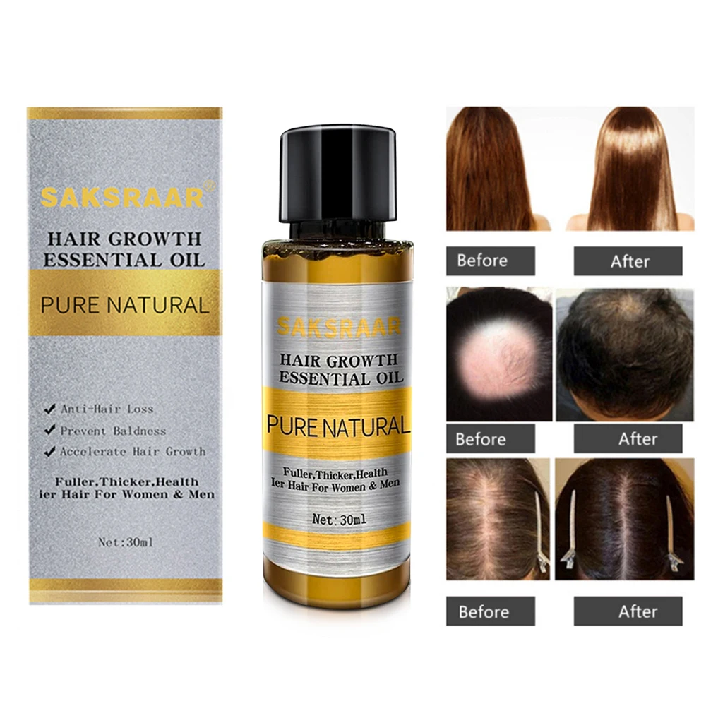 

30ml Hair Growth Essential Oils Essence Original Authentic Hair Loss Liquid Health Care Beauty Dense Hair Growth Serum Hair Care