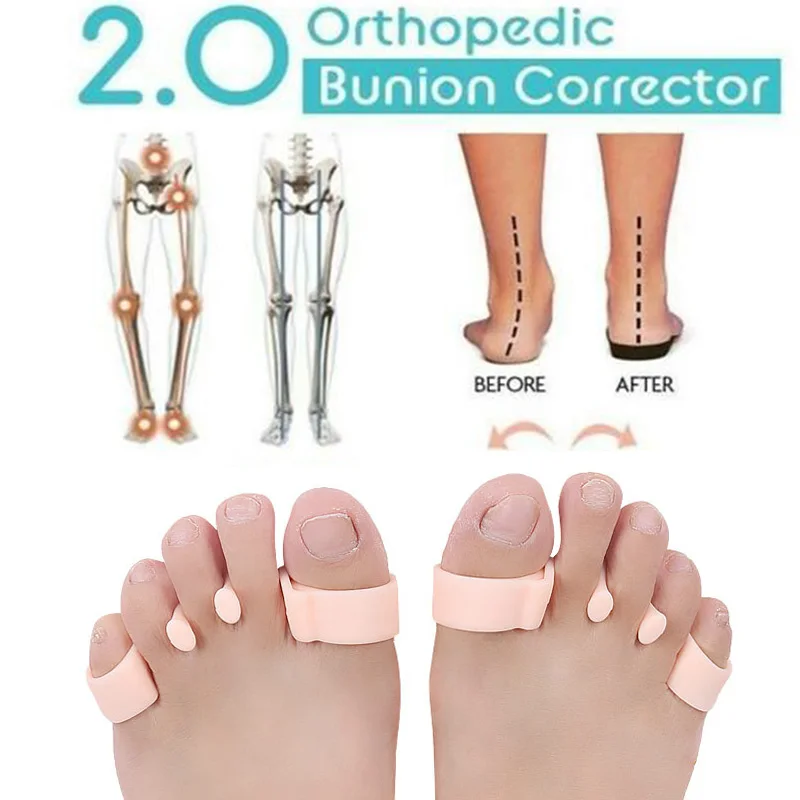 Регулятор кости ног носок для ухода за кожей стоп вальгусная деформация с бантом