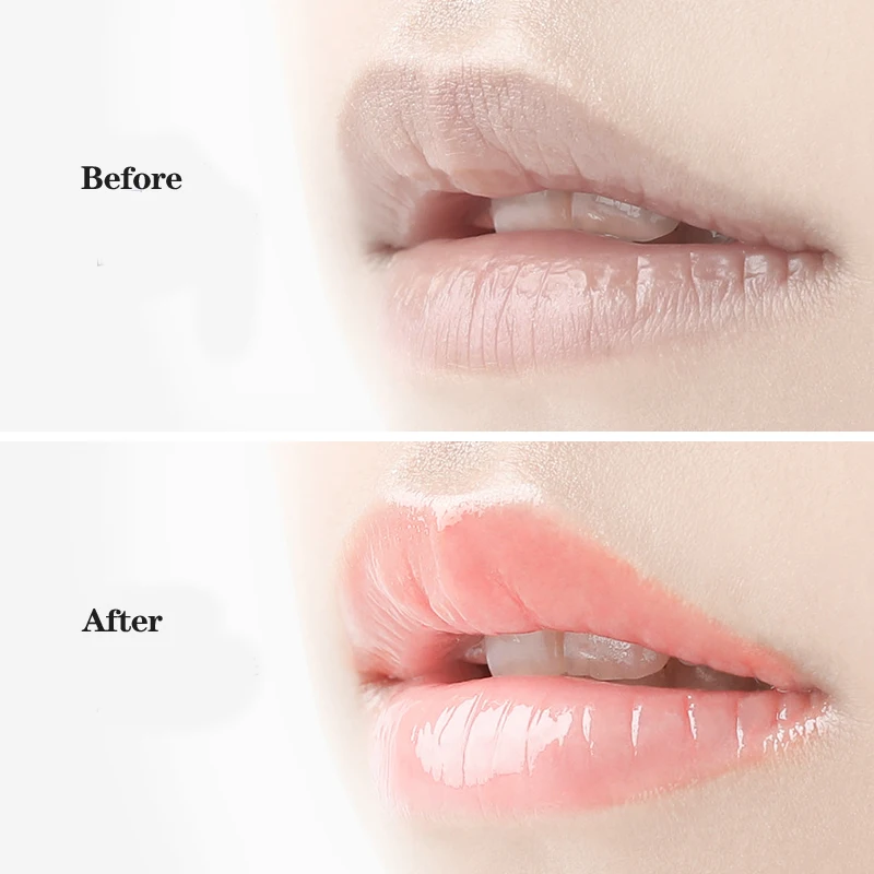 Обезболивающий бальзам для губ listex увлажняющий сухих маска губ|Губы| |