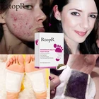 5 пар, пластырь RtopR для похудения, с полынью, для здоровья тела, Детокс, для ног, эффективное улучшение качества сна, органические, Детокс, красота