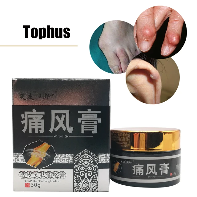 Gout Ointment Transdermal Polypeptide Treatment Joint Bone Pain Killer Sore Neck Muscle Relaxation Drug Health Care Plasters 6