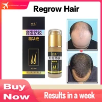 fast hair growth oil prevent hair loss treatment herbal medicine extract growing hair products for hair care and scalp 50ml