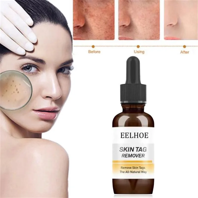 

Mole & Skin Tag Removal Solution Painless Mole Skin Spot Removal Oil Wart Dark Removal Cream Face Freckle Tag T1J5