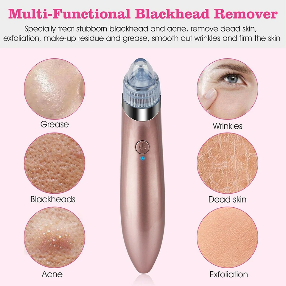 Инструмент для красоты угрей 20|Устройство ухода за кожей лица| |