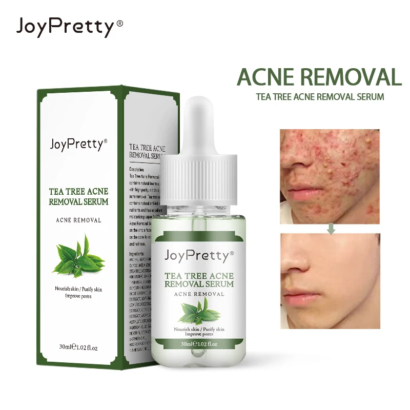 

JoyPretty Tea Tree Acne Face Serum Hyaluronic Acid Face Acne Treatment Essence Moisturizer Whitening Skin Care Cosmetics 30ml
