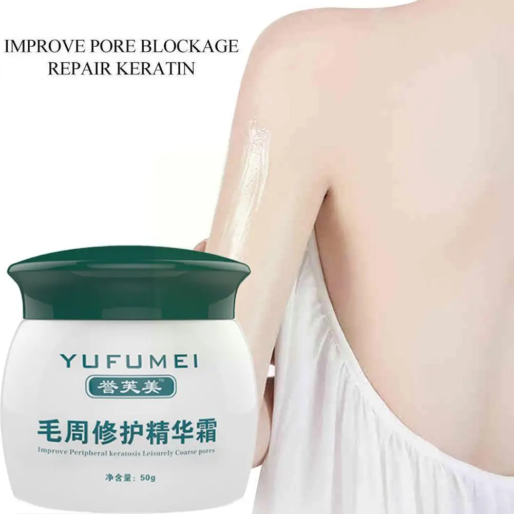 

50g Moisturizing And Nourishing Essence Curing Keratosis Care Cream Skin Lotion Kp/ Skin Pilaris/ Body Chicken Repair Skin O8p5