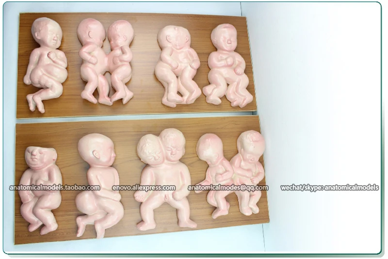 CMAM/12452 патологическая модель плода мочеполового и медицинского обучения