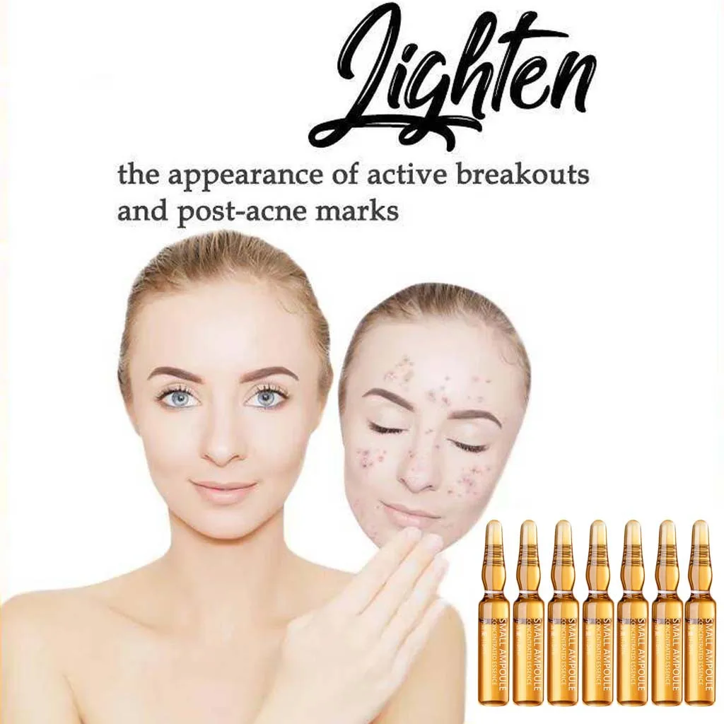 Силиконовая электрическая маленькая щетка для шампуня Соник массажный уход