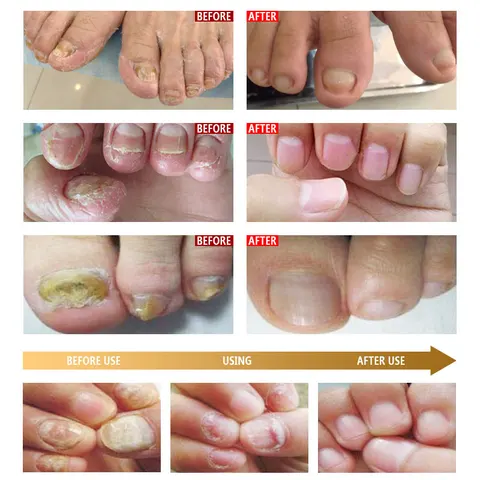 ARTISCARE Сыворотка для ногтей 20 мл