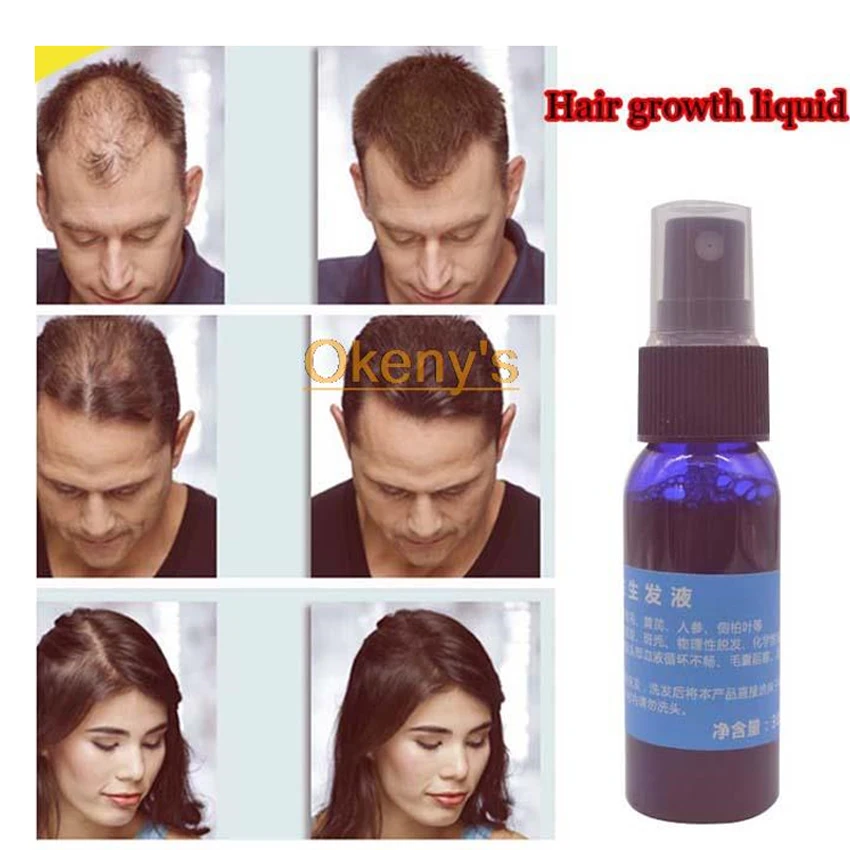 Okeny's бренд Yuda Pilatory стоп выпадение волос быстрый рост волос продукты для мужчин и женщин эссенция для роста волос Восстановление роста 30 мл