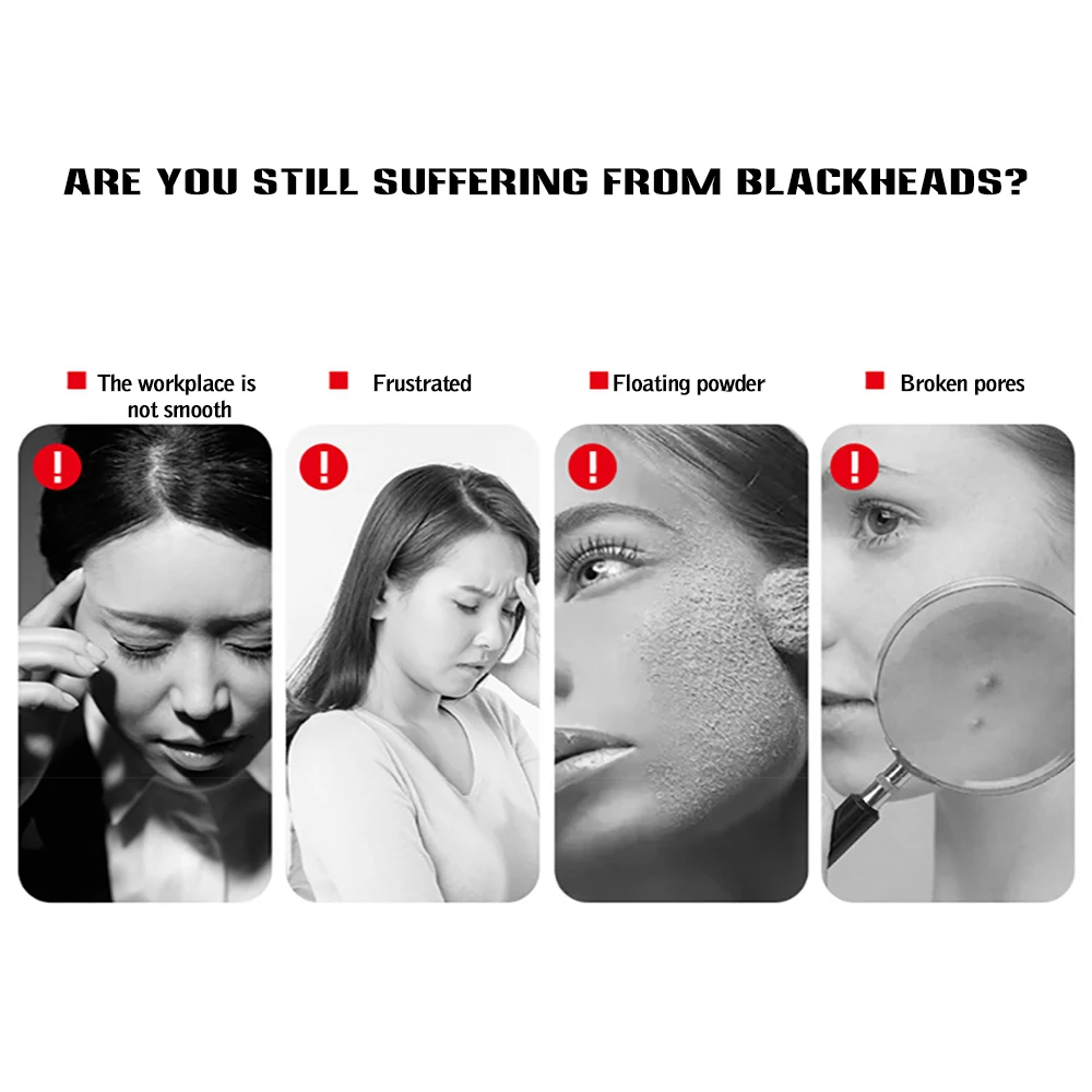 Face Nose Acne Black Dot Remover пылесос для чистки пор Сменный наконечник Электрический пылесос Инструменты для ухода за кожей Машина
